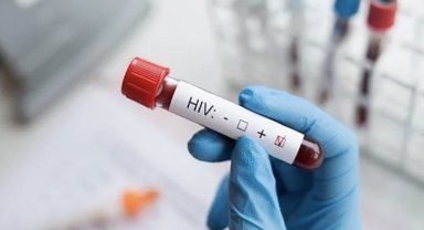 İzmir'de 13 Yaşındaki çocuğun AIDS nedeniyle ölümü üzerine soruşturma başlatıldı