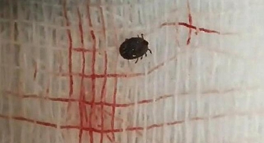 Tokat'ta kenenin tutunduğu 60 yaşındaki kişi yaşamını yitirdi